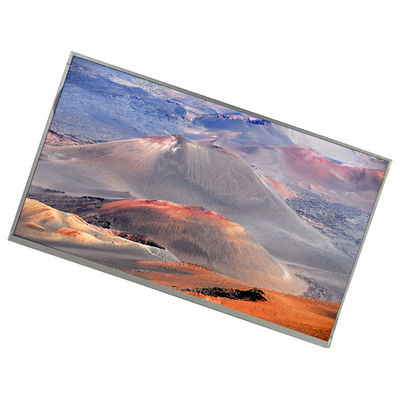 سعر جيد M215H1-L01 21.5 بوصة 1920*1080 tft ips شاشة شاشة شاشة شاشة شاشة شاشة شاشة شاشة شاشة شاشة شاشة شاشة شاشة شاشة شاشة شاشة شاشة شاشة شاشة شاشة شاشة شاشة شاشة شاشة شاشة شاشة شاشة شاشة شاشة شاشة شاشة شاشة شاشة شاشة شاشة شاشة شاشة شاشة شاشة شاشة شاشة شاشة شاشة شاشة شاشة شاشة شاشة شاشة شاشة شاشة شاشة شاشة شاشة شاشة شاشة شاشة شاشة شاشة شاشة شاشة شاشة شاشة شاشة شاشة شاشة شاشة شاشة شاشة شاشة شاشة شاشة شاشة شاشة شاشة شاشة شاشة شاشة الانترنت